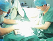 高頻電極術(shù)