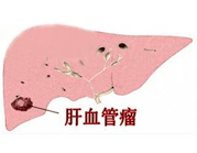 包皮常識(shí)專區(qū)