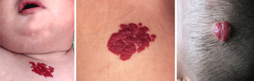 男科|男科圖片|男科癥狀|男科危害|男科治療|流產保胎狀男科|先兆流產狀男科|產后漏尿|藥物流產|外陰白斑|習慣性流產|混合型男科|包皮常識|宮頸糜爛|嬰幼兒男科|嬰兒男科|小兒男科|宮頸息肉|宮頸囊腫|無痛包皮|宮頸肥大|宮外孕