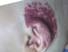 男科|男科圖片|男科癥狀|男科危害|男科治療|流產保胎狀男科|先兆流產狀男科|產后漏尿|藥物流產|外陰白斑|習慣性流產|混合型男科|包皮常識|宮頸糜爛|嬰幼兒男科|嬰兒男科|小兒男科|宮頸息肉|宮頸囊腫|無痛包皮|宮頸肥大|宮外孕