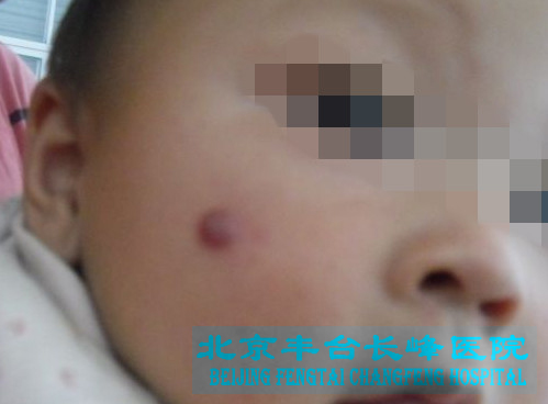 男科|男科圖片|男科癥狀|男科危害|男科治療|流產保胎狀男科|先兆流產狀男科|產后漏尿|藥物流產|外陰白斑|習慣性流產|混合型男科|包皮常識|宮頸糜爛|嬰幼兒男科|嬰兒男科|小兒男科|宮頸息肉|宮頸囊腫|無痛包皮|宮頸肥大|宮外孕