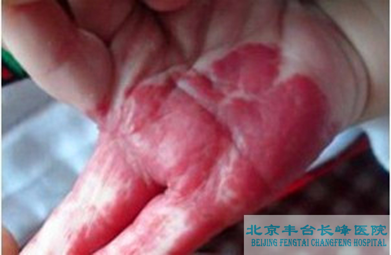 男科|男科圖片|男科癥狀|男科危害|男科治療|流產(chǎn)保胎狀男科|先兆流產(chǎn)狀男科|產(chǎn)后漏尿|藥物流產(chǎn)|外陰白斑|習(xí)慣性流產(chǎn)|混合型男科|包皮常識|宮頸糜爛|嬰幼兒男科|嬰兒男科|小兒男科|宮頸息肉|宮頸囊腫|無痛包皮|宮頸肥大|宮外孕