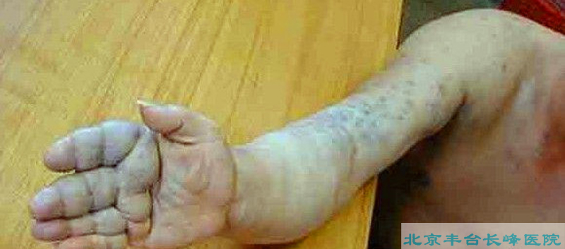 男科|男科圖片|男科癥狀|男科危害|男科治療|流產保胎狀男科|先兆流產狀男科|產后漏尿|藥物流產|外陰白斑|習慣性流產|混合型男科|包皮常識|宮頸糜爛|嬰幼兒男科|嬰兒男科|小兒男科|宮頸息肉|宮頸囊腫|無痛包皮|宮頸肥大|宮外孕