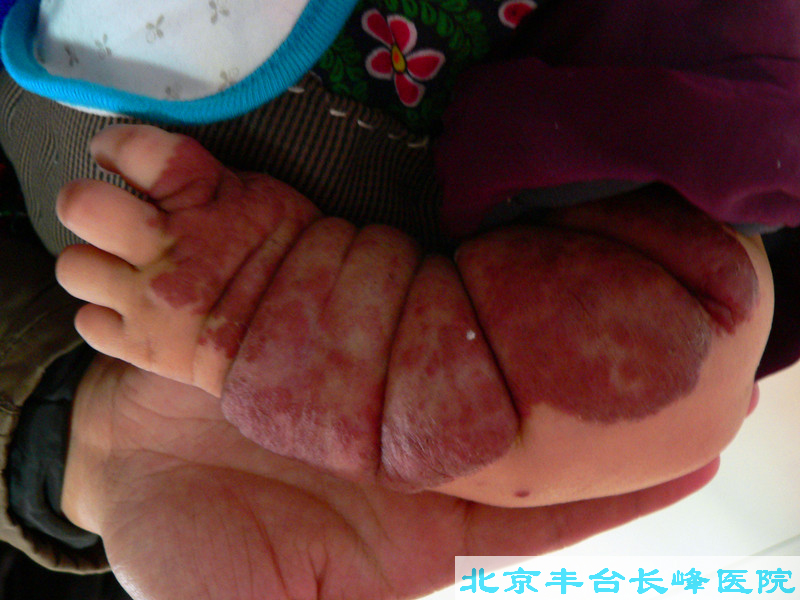 男科|男科圖片|男科癥狀|男科危害|男科治療|流產保胎狀男科|先兆流產狀男科|產后漏尿|藥物流產|外陰白斑|習慣性流產|混合型男科|包皮常識|宮頸糜爛|嬰幼兒男科|嬰兒男科|小兒男科|宮頸息肉|宮頸囊腫|無痛包皮|宮頸肥大|宮外孕