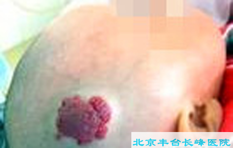 男科|男科圖片|男科癥狀|男科危害|男科治療|流產保胎狀男科|先兆流產狀男科|產后漏尿|藥物流產|外陰白斑|習慣性流產|混合型男科|包皮常識|宮頸糜爛|嬰幼兒男科|嬰兒男科|小兒男科|宮頸息肉|宮頸囊腫|無痛包皮|宮頸肥大|宮外孕