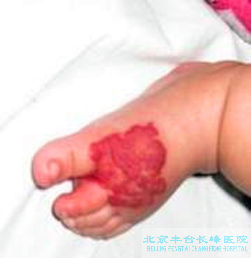 男科|男科圖片|男科癥狀|男科危害|男科治療|流產保胎狀男科|先兆流產狀男科|產后漏尿|藥物流產|外陰白斑|習慣性流產|混合型男科|包皮常識|宮頸糜爛|嬰幼兒男科|嬰兒男科|小兒男科|宮頸息肉|宮頸囊腫|無痛包皮|宮頸肥大|宮外孕