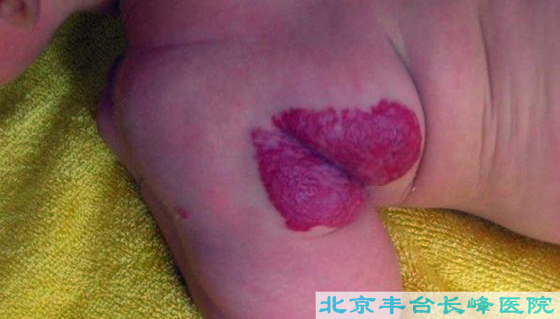 男科|男科圖片|男科癥狀|男科危害|男科治療|流產保胎狀男科|先兆流產狀男科|產后漏尿|藥物流產|外陰白斑|習慣性流產|混合型男科|包皮常識|宮頸糜爛|嬰幼兒男科|嬰兒男科|小兒男科|宮頸息肉|宮頸囊腫|無痛包皮|宮頸肥大|宮外孕