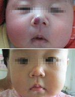 男科|男科圖片|男科癥狀|男科危害|男科治療|流產保胎狀男科|先兆流產狀男科|產后漏尿|藥物流產|外陰白斑|習慣性流產|混合型男科|包皮常識|宮頸糜爛|嬰幼兒男科|嬰兒男科|小兒男科|宮頸息肉|宮頸囊腫|無痛包皮|宮頸肥大|宮外孕