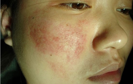 男科|男科圖片|男科癥狀|男科危害|男科治療|流產保胎狀男科|先兆流產狀男科|產后漏尿|藥物流產|外陰白斑|習慣性流產|混合型男科|包皮常識|宮頸糜爛|嬰幼兒男科|嬰兒男科|小兒男科|宮頸息肉|宮頸囊腫|無痛包皮|宮頸肥大|宮外孕