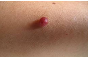 男科|男科圖片|男科癥狀|男科危害|男科治療|流產保胎狀男科|先兆流產狀男科|產后漏尿|藥物流產|外陰白斑|習慣性流產|混合型男科|包皮常識|宮頸糜爛|嬰幼兒男科|嬰兒男科|小兒男科|宮頸息肉|宮頸囊腫|無痛包皮|宮頸肥大|宮外孕