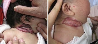 男科圖片/上環取環治療圖片