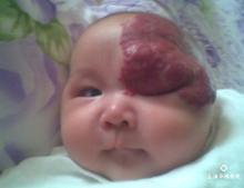 動靜脈男科圖片