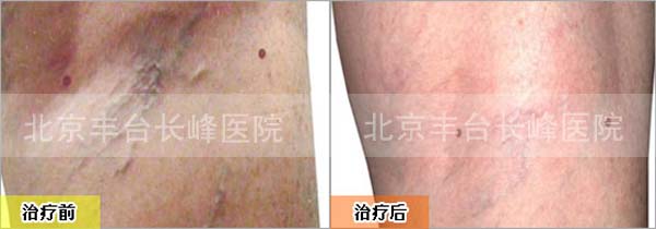 男科|男科圖片|男科癥狀|男科危害|男科治療|流產保胎狀男科|先兆流產狀男科|產后漏尿|藥物流產|外陰白斑|習慣性流產|混合型男科|包皮常識|宮頸糜爛|嬰幼兒男科|嬰兒男科|小兒男科|宮頸息肉|宮頸囊腫|無痛包皮|宮頸肥大|宮外孕